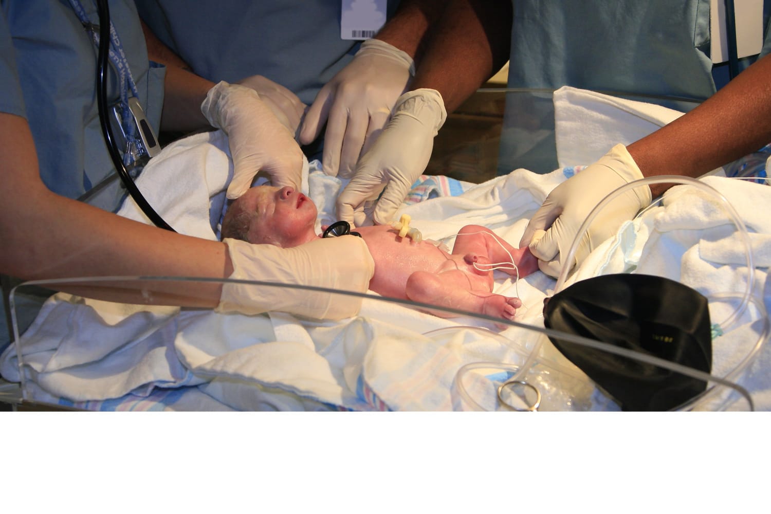 Imagine - What It’s Like to Give Birth Prematurely